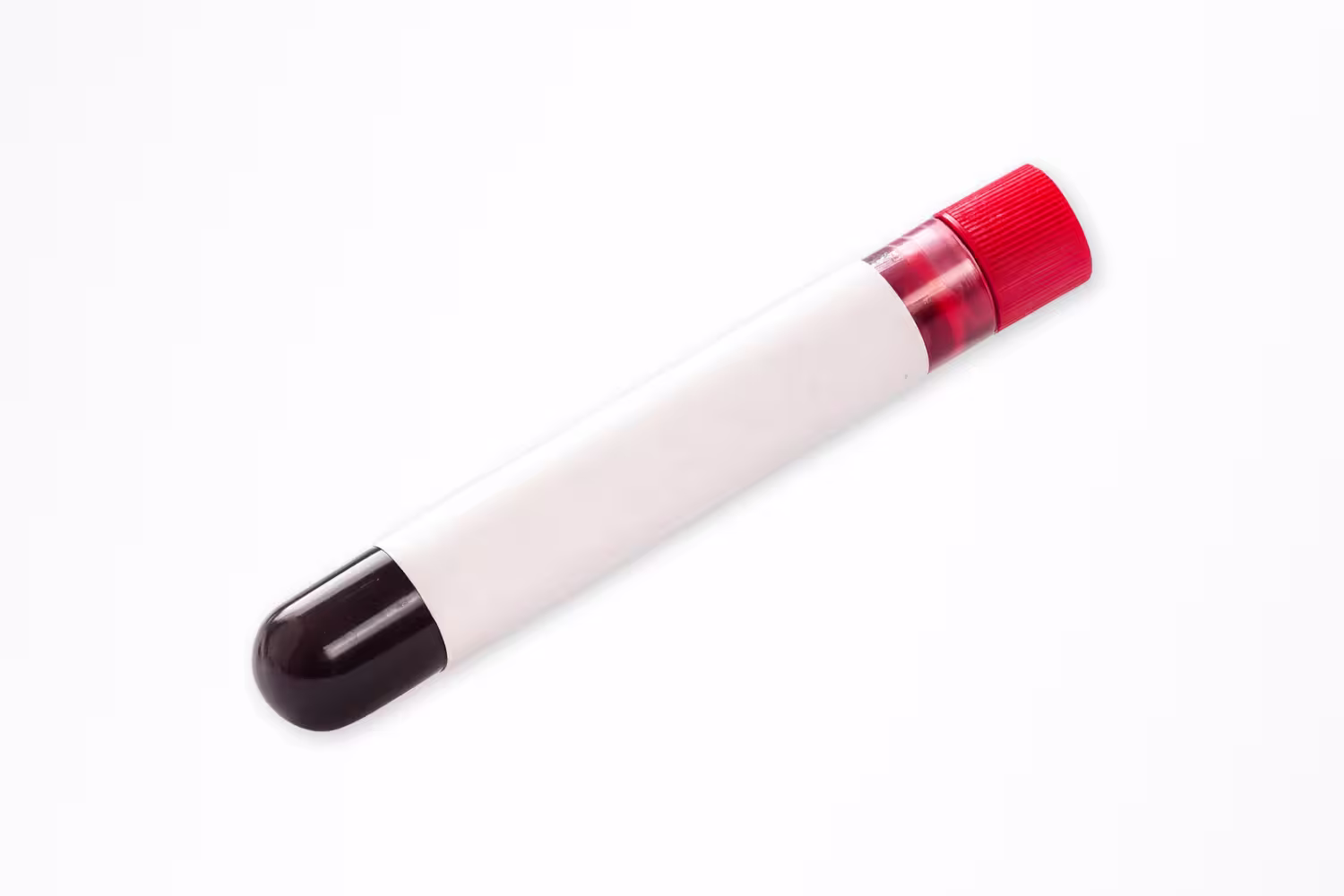 Umbilical Cord Plasma Umbilical Cord Plasma