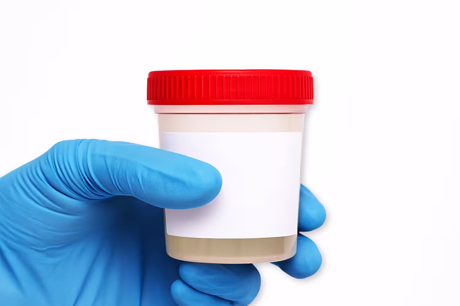 Umbilical Cords Umbilical Cords